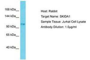 Image no. 1 for anti-SKI/DACH Domain Containing 1 (SKIDA1) (AA 772-821) antibody (ABIN6750805) (SKIDA1 Antikörper  (AA 772-821))