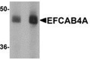 Western blot analysis of EFCAB4A in human lung tissue lysate with EFCAB4A antibody at (A) 1 and (B) 2 μg/ml. (EFCAB4A Antikörper  (Center))