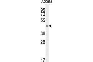 WDR21C Antibody (N-term) western blot analysis in A2058 cell line lysates (35 µg/lane). (DCAF4L2 Antikörper  (N-Term))