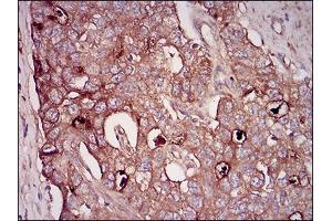 Immunohistochemistry (IHC) image for anti-5'-Nucleotidase, Ecto (CD73) (NT5E) (AA 30-250) antibody (ABIN1724945)