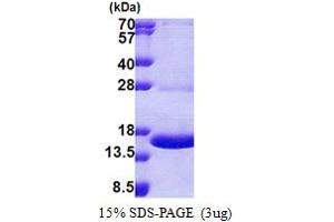 SDS-PAGE (SDS) image for Myelin Protein Zero-Like 1 (MPZL1) (AA 38-162) protein (His tag) (ABIN5853109) (MPZL1 Protein (AA 38-162) (His tag))