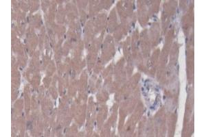 DAB staining on IHC-P; Samples: Rat Heart Tissue (BCAT1 Antikörper  (AA 179-411))