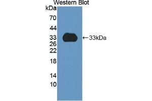 Detection of Recombinant CYP1A2, Rat using Polyclonal Antibody to Cytochrome P450 1A2 (CYP1A2) (CYP1A2 Antikörper  (AA 192-444))