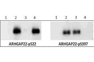 Western Blot of Rabbit anti-ARHGAP22 pS397 antibody. (ARHGAP22 Antikörper  (phosphorylated))