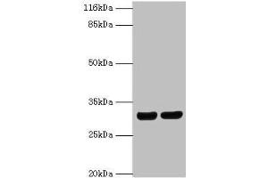 Western blot All lanes: HLA-DRB1 antibody at 2 μg/mL Lane 1: A375 whole cell lysate Lane 2: Raji whole cell lysate Secondary Goat polyclonal to rabbit IgG at 1/10000 dilution Predicted band size: 30 kDa Observed band size: 30 kDa (HLA-DRB1 Antikörper  (AA 30-266))