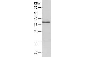 Western Blotting (WB) image for Apurinic/Apyrimidinic Endonuclease 1 (APEX1) (AA 1-318) protein (His tag) (ABIN7121879) (APEX1 Protein (AA 1-318) (His tag))
