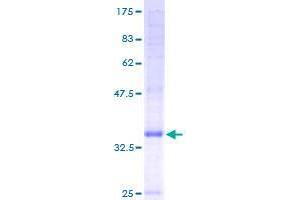 Image no. 1 for Cornichon Homolog 4 (CNIH4) (AA 1-139) protein (GST tag) (ABIN1349826) (CNIH4 Protein (AA 1-139) (GST tag))