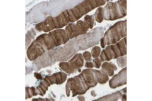 Immunohistochemical staining of human skeletal muscle with TMCO4 polyclonal antibody  shows strong cytoplasmic positivity in myocytes at 1:200-1:500 dilution. (TMCO4 Antikörper)