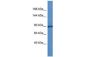 Western Blot showing Pygm antibody used at a concentration of 1. (PYGM Antikörper  (C-Term))