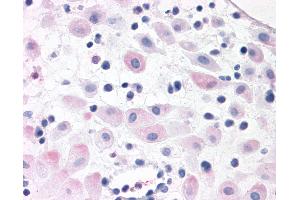 Anti-BRS3 antibody IHC of human pregnant uterus. (BRS3 Antikörper  (N-Term))