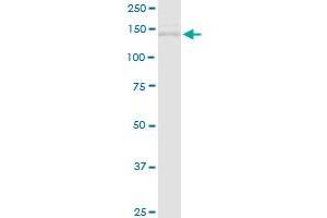 TIMELESS MaxPab rabbit polyclonal antibody. (TIMELESS Antikörper  (AA 1-1208))