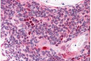 Human Thymus (formalin-fixed, paraffin-embedded) stained with AIRE antibody ABIN291034 at 2. (AIRE Antikörper  (AA 534-545))