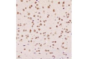 Immunohistochemistry of paraffin embedded mouse brain using SR140 (ABIN7076091) at dilution of 1:1000 (400x lens) (SR140 Antikörper)