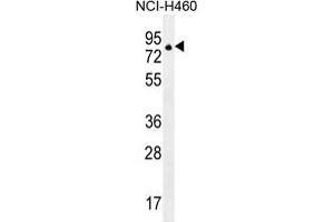 ZNF28 Antibody (N-term) western blot analysis in NCI-H460 cell line lysates (35 µg/lane). (ZFP28 Antikörper  (N-Term))