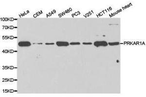 Western Blotting (WB) image for anti-Protein Kinase, CAMP-Dependent, Regulatory, Type I, alpha (Tissue Specific Extinguisher 1) (PRKAR1A) antibody (ABIN1874285) (PRKAR1A Antikörper)