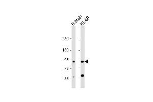All lanes : Anti-CCDC144A Antibody (C-Term) at 1:2000 dilution Lane 1: human brain lysate Lane 2: HL-60 whole cell lysate Lysates/proteins at 20 μg per lane. (CCDC144A Antikörper  (AA 1257-1289))