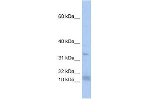 WB Suggested Anti-SF3B14 Antibody Titration:  0. (Pre-mRNA Branch Site Protein p14 (SF3B14) (N-Term) Antikörper)