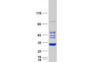 RABL2A Protein (Transcript Variant 2) (Myc-DYKDDDDK Tag)