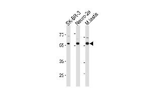 RELA Antibody (p) (ABIN1881742 and ABIN2839052) western blot analysis in SK-BR-3,mouse Neuro-2a cell line and mouse testis tissue lysates (35 μg/lane). (NF-kB p65 Antikörper  (C-Term))