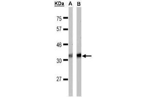 WB Image Sample(30 μg of whole cell lysate) A:MOLT4 , B:Raji , 15% SDS PAGE antibody diluted at 1:1000 (FFAR1 Antikörper  (C-Term))