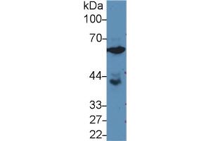 Western blot analysis of Human PC3 cell lysate, using Rat GPI Antibody (3 µg/ml) and HRP-conjugated Goat Anti-Rabbit antibody (