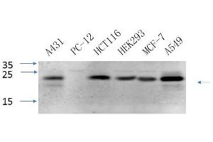 Western Blotting (WB) image for anti-Caveolin 1, Caveolae Protein, 22kDa (CAV1) antibody (ABIN5960477) (Caveolin-1 Antikörper)