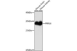 Western blot analysis of extracts of various cell lines, using PRR16 Rabbit pAb (ABIN7269554) at 1:1000 dilution. (PRR16 Antikörper  (AA 50-150))