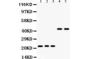 Anti- GPX1 antibody, Western blotting All lanes: Anti GPX1  at 0. (Glutathione Peroxidase 1 Antikörper  (Middle Region))