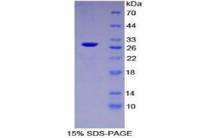 SDS-PAGE (SDS) image for Poly (ADP-Ribose) Polymerase 1 (PARP1) (AA 661-881) protein (His tag) (ABIN1879706) (PARP1 Protein (AA 661-881) (His tag))
