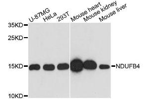 Western blot analysis of extracts of various cell lines, using NDUFB4 antibody. (NDUFB4 Antikörper  (AA 1-90))