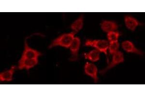 ABIN6268739 staining HeLa by IF/ICC. (Cathepsin D Antikörper  (C-Term))
