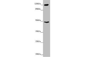 Western blot All lanes: INPP4A antibody at 8. (INPP4A Antikörper  (AA 1-250))
