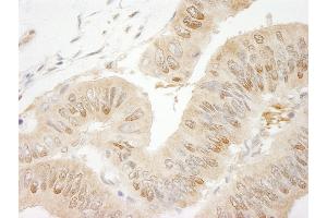 Immunohistochemistry (IHC) image for anti-RAN Binding Protein 1 (RANBP1) (AA 1-50) antibody (ABIN7449008)