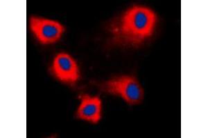 Immunofluorescent analysis of ARFIP1 staining in HeLa cells. (ARFIP1 Antikörper  (C-Term))