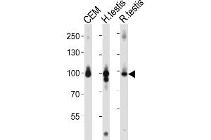 Western blot analysis of lysates from CEM cell line, human testis, rat testis tissue lysate (from left to right), using AC Antibody (C-term) 1151a. (Centaurin beta 2 Antikörper  (C-Term))