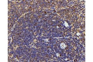 Immunohistochemistry (Paraffin-embedded Sections) (IHC (p)) image for anti-Interleukin 22 Receptor, alpha 1 (IL22RA1) antibody (ABIN7249632)