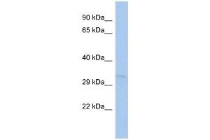 WB Suggested Anti-TOMM40L Antibody Titration:  0. (TOMM40L Antikörper  (Middle Region))