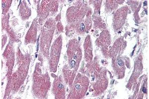 Human Heart (formalin-fixed, paraffin-embedded) stained with GPR116 antibody ABIN399995 at 10 ug/ml followed by biotinylated goat anti-rabbit IgG secondary antibody ABIN481713, alkaline phosphatase-streptavidin and chromogen. (G Protein-Coupled Receptor 116 Antikörper  (Internal Region))