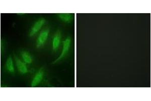 Immunofluorescence analysis of HeLa cells, using HEXIM1 Antibody. (HEXIM1 Antikörper  (AA 181-230))
