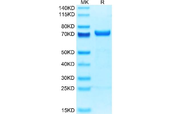 MMP2 Protein (AA 34-660) (His tag)
