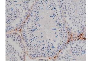 Immunohistochemistry (IHC) image for anti-V-Yes-1 Yamaguchi Sarcoma Viral Related Oncogene Homolog (LYN) (pTyr507) antibody (ABIN6256754)