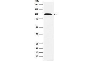 Western blot analysis of AP1G1 expression in 293T cell lysate. (Rekombinanter gamma 1 Adaptin Antikörper)