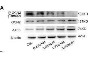 BCAA increase PPAR-α expression in a GCN2/ATF6 pathway-dependent manner. (beta Actin Antikörper)