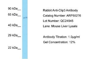 Western Blotting (WB) image for anti-CAP-GLY Domain Containing Linker Protein 3 (CLIP3) (N-Term) antibody (ABIN2786121) (CLIP3 Antikörper  (N-Term))