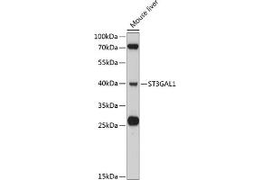 Western blot analysis of extracts of mouse liver, using ST3G antibody (ABIN6130190, ABIN6148520, ABIN6148522 and ABIN6215305) at 1:3000 dilution. (ST3GAL1 Antikörper  (AA 35-135))