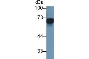 Mouse Capture antibody from the kit in WB with Positive Control: Human SGC7901 cell lysate. (MMP3 CLIA Kit)