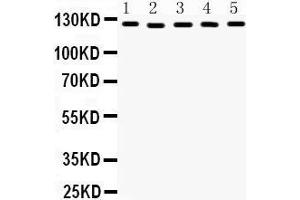 Western Blotting (WB) image for anti-Damage Specific DNA Binding Protein 1 (DDB1) (AA 1011-1140) antibody (ABIN3043823)
