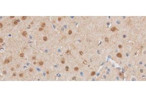 Immunohistochemistry of paraffin-embedded Mouse brain using MAP2K6 Polyclonal Antibody at dilution of 1:50 (MAP2K6 Antikörper)