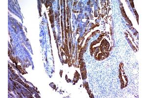Immunohistochemistry (IHC) image for anti-Mucin 2, Oligomeric Mucus/gel-Forming (MUC2) antibody (ABIN6940118)