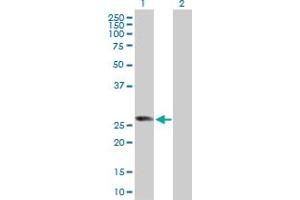 Western Blot analysis of RABL2B expression in transfected 293T cell line by RABL2B MaxPab polyclonal antibody. (RABL2B Antikörper  (AA 1-229))